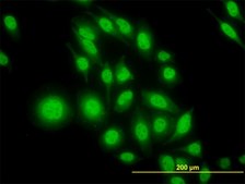 Monoclonal Anti-ATF4 antibody produced in mouse clone 2B3, purified immunoglobulin, buffered aqueous solution