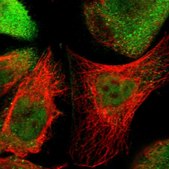 Anti-STK40 antibody produced in rabbit Prestige Antibodies® Powered by Atlas Antibodies, affinity isolated antibody, buffered aqueous glycerol solution