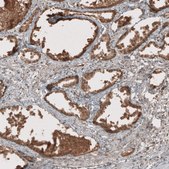 Anti-RAB11FIP3 antibody produced in rabbit Prestige Antibodies® Powered by Atlas Antibodies, affinity isolated antibody, buffered aqueous glycerol solution, ab2