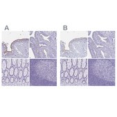 Anti-CCDC39 antibody produced in rabbit Prestige Antibodies® Powered by Atlas Antibodies, affinity isolated antibody, buffered aqueous glycerol solution