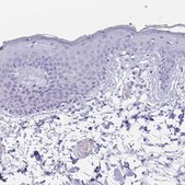 Anti-ST8SIA5 antibody produced in rabbit Prestige Antibodies® Powered by Atlas Antibodies, affinity isolated antibody, buffered aqueous glycerol solution