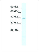 Anti-PITX2 IgG fraction of antiserum