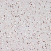 Anti-Phospho-RPS6KA5-S376 antibody produced in rabbit