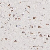 Anti-RNF213 antibody produced in rabbit Prestige Antibodies® Powered by Atlas Antibodies, affinity isolated antibody, buffered aqueous glycerol solution