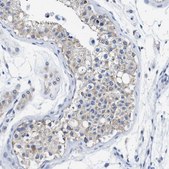 Anti-TBRG4 antibody produced in rabbit Prestige Antibodies® Powered by Atlas Antibodies, affinity isolated antibody, buffered aqueous glycerol solution