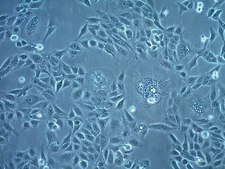 OECM-1 Human Oral Squamous Carcinoma Cell Line OECM-1 human oral squamous carcinoma cell line is suitable for studies of cancer cell signaling, epithelial-mesenchymal transition (EMT), metastasis, invasion, and cancer cell stemness.