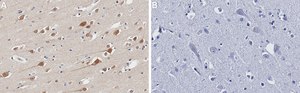 Anti-JNK2 Antibody, clone 1F16 ZooMAb® Rabbit Monoclonal recombinant, expressed in HEK 293 cells