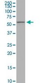 Monoclonal Anti-PIGW antibody produced in mouse clone 1D8, purified immunoglobulin