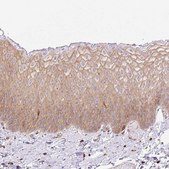 Anti-DNM2 antibody produced in rabbit Prestige Antibodies® Powered by Atlas Antibodies, affinity isolated antibody, buffered aqueous glycerol solution