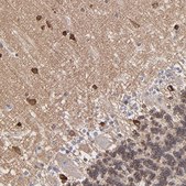 Anti-PSD3 antibody produced in rabbit Prestige Antibodies® Powered by Atlas Antibodies, affinity isolated antibody