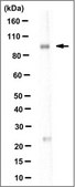 Anti-ADAR2 Antibody, clone 2D1.1 clone 2D1.1, 1 mg/mL, from mouse