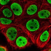 Anti-HNRNPL antibody produced in rabbit Prestige Antibodies® Powered by Atlas Antibodies, affinity isolated antibody, buffered aqueous glycerol solution