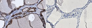 Anti-GRP78/BiP (ET-21) antibody produced in rabbit IgG fraction of antiserum, buffered aqueous solution