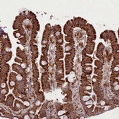 Anti-LGALS9 antibody produced in rabbit Prestige Antibodies® Powered by Atlas Antibodies, affinity isolated antibody, buffered aqueous glycerol solution