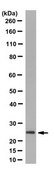 Anti-Thymidylate Kinase/TMPK Antibody, clone 1A5.1 clone 1A5.1, from mouse