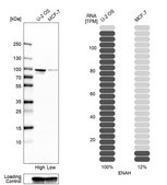 Anti-ENAH antibody produced in rabbit Prestige Antibodies® Powered by Atlas Antibodies, affinity isolated antibody, buffered aqueous glycerol solution, ab1