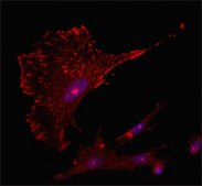 Anti-Tensin 1 antibody produced in rabbit ~1.0 mg/mL, affinity isolated antibody