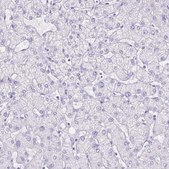 Anti-SLC13A2 antibody produced in rabbit Prestige Antibodies® Powered by Atlas Antibodies, affinity isolated antibody, buffered aqueous glycerol solution