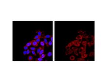 Anti-SMN Antibody, clone 2B1 clone 2B1, from mouse