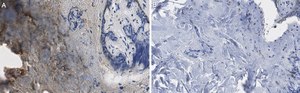Anti-Collagen Type III Antibody, clone 3N18 ZooMAb® Rabbit Monoclonal recombinant, expressed in HEK 293 cells