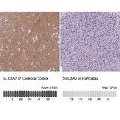 Anti-SLC8A2 antibody produced in rabbit Prestige Antibodies® Powered by Atlas Antibodies, affinity isolated antibody, buffered aqueous glycerol solution