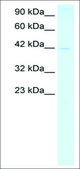 Anti-FOXP1 antibody produced in rabbit IgG fraction of antiserum