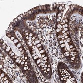 Anti-FGFBP2 antibody produced in rabbit Prestige Antibodies® Powered by Atlas Antibodies, affinity isolated antibody, buffered aqueous glycerol solution