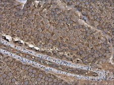 Anti-GNB1 antibody produced in rabbit affinity isolated antibody, buffered aqueous solution