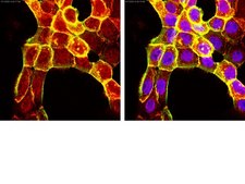 Anti-PHLPP1 Antibody from rabbit, purified by affinity chromatography