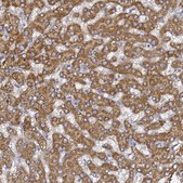 Anti-C19orf12 antibody produced in rabbit Prestige Antibodies® Powered by Atlas Antibodies, affinity isolated antibody, buffered aqueous glycerol solution