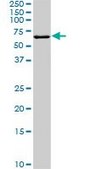 Monoclonal Anti-FGR antibody produced in mouse clone 3G10, purified immunoglobulin, buffered aqueous solution