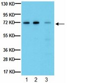 Anti-Endoglin Antibody, clone P3D1 clone P3D1, from mouse