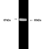 Anti-Glutamate Decarboxylase 65 &amp; 67 Antibody Chemicon®, from rabbit