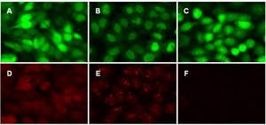 LentiBrite GFP-LC3 Control Mutant Lentiviral Biosensor