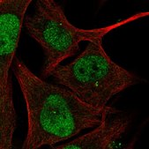 Anti-ZBTB24 antibody produced in rabbit Prestige Antibodies® Powered by Atlas Antibodies, affinity isolated antibody, buffered aqueous glycerol solution