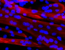 Monoclonal Anti-Myosin (Skeletal, Fast)−Alkaline Phosphatase antibody produced in mouse clone MY-32, purified from hybridoma cell culture