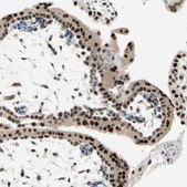 Anti-RNF43 antibody produced in rabbit Prestige Antibodies® Powered by Atlas Antibodies, affinity isolated antibody, buffered aqueous glycerol solution