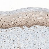 Anti-TET1 antibody produced in rabbit Prestige Antibodies® Powered by Atlas Antibodies, affinity isolated antibody, buffered aqueous glycerol solution