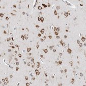 Anti-LARP4B antibody produced in rabbit Prestige Antibodies® Powered by Atlas Antibodies, affinity isolated antibody, buffered aqueous glycerol solution