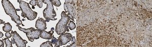 Anti-MMP-11 (Stromelysin-3) Antibody, clone 5ST-4A9 clone 5ST-4A9, from mouse