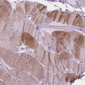 Anti-IGFN1 antibody produced in rabbit Prestige Antibodies® Powered by Atlas Antibodies, affinity isolated antibody, buffered aqueous glycerol solution