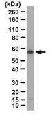 Anti-FKBP5 Antibody from rabbit, purified by affinity chromatography