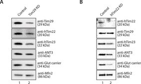 Anti-TIMM29 antibody produced in rabbit Prestige Antibodies® Powered by Atlas Antibodies, affinity isolated antibody, buffered aqueous glycerol solution