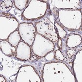 Anti-EIF2B2 antibody produced in rabbit Prestige Antibodies® Powered by Atlas Antibodies, affinity isolated antibody, buffered aqueous glycerol solution