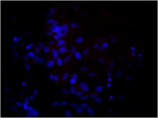 Anti-Nestin Antibody, clone rat-401, Biotin Conjugate clone rat-401, from mouse, biotin conjugate