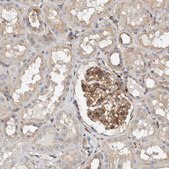 Anti-BNIP2 antibody produced in rabbit Prestige Antibodies® Powered by Atlas Antibodies, affinity isolated antibody, buffered aqueous glycerol solution