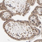 Anti-PRKAB1 antibody produced in rabbit Prestige Antibodies® Powered by Atlas Antibodies, affinity isolated antibody, buffered aqueous glycerol solution
