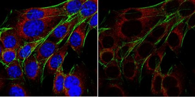 Anti-GRP-78 from rabbit, purified by affinity chromatography