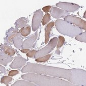Anti-NUDT8 antibody produced in rabbit Prestige Antibodies® Powered by Atlas Antibodies, affinity isolated antibody, buffered aqueous glycerol solution