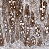 Anti-MB21D1 antibody produced in rabbit Prestige Antibodies® Powered by Atlas Antibodies, affinity isolated antibody
